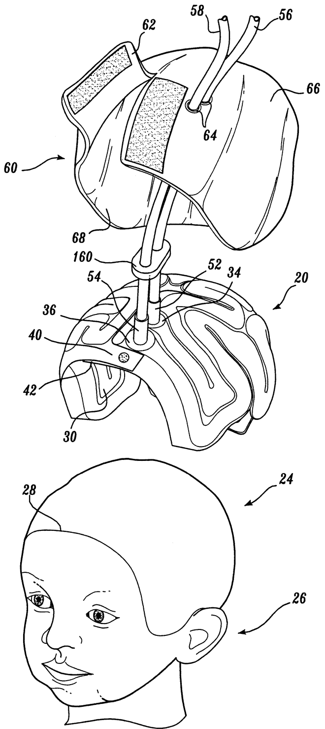 Device for Cooling Infant's Brain